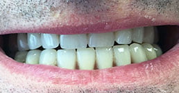 Zahnbehandlung in Ungarn Erfahrungen
