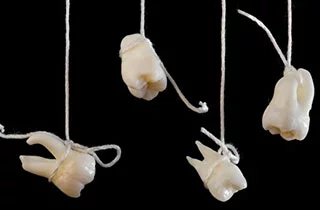 How much does a dentist get paid for a tooth extraction? wisdom tooth removalcosts