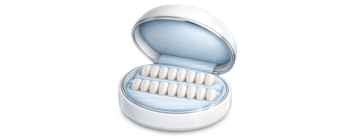 20veneers Paket
